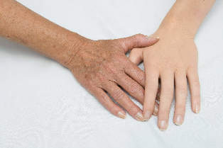 podmlađivanje kože od ruke