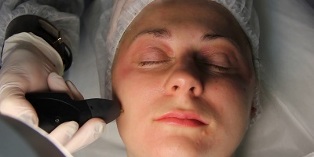 kako se pripremiti za postupak podmlađivanja kože u plazmi